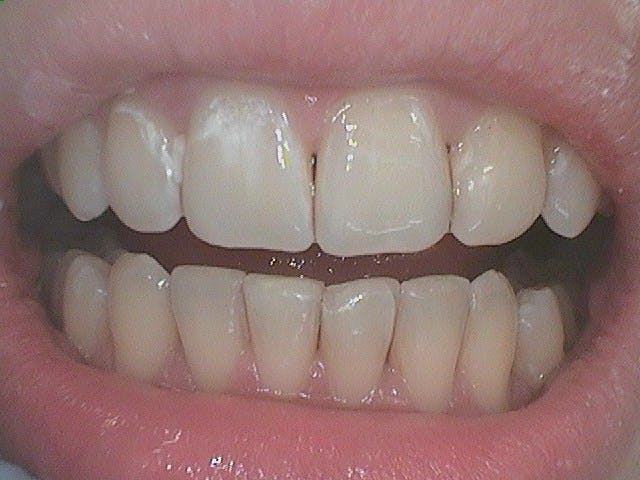 Cosmetic Dentistry Before 01