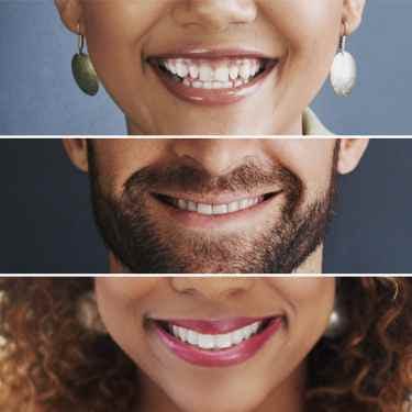Different smiles represent different dental care needs