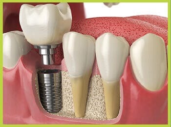 Stonebrook Dental